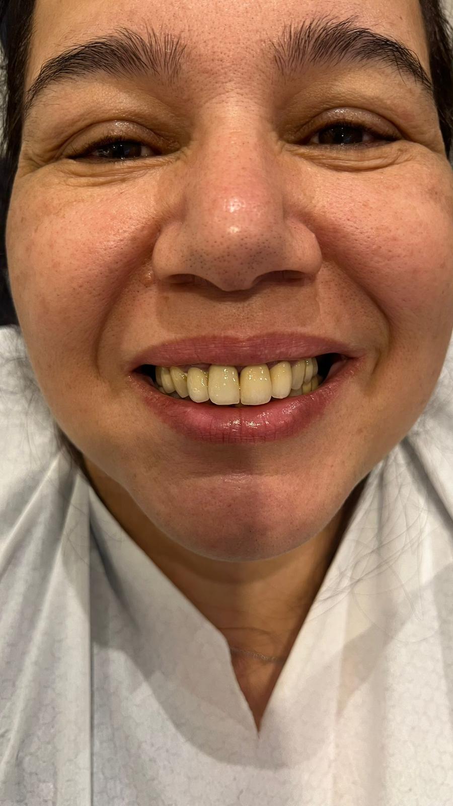 ECE Dental Patient Transformation